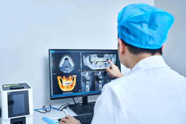 Best Emergency Wisdom Tooth Extraction in Depew, NY
